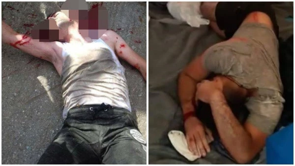 Παγκόσμιο θέμα οι μάχες μέχρις θανάτου ισλαμιστών-Κούρδων στην Λέσβο -Μιλούν για 4 νεκρούς, 20 τραυματίες